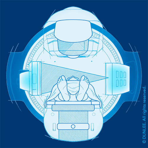 Illustration of onboard imaging on a radiotherapy system.