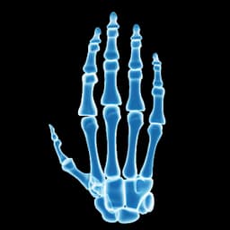 Diagnosis of complex bone pathologies