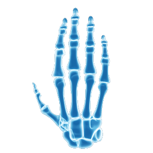 Diagnosis of complex bone pathologies